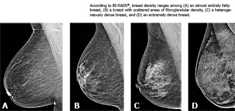 Rads 4b. Классификация ACR молочной железы. ACR классификация маммография. Классификация bi rads. Birads 4 молочной железы что это такое.